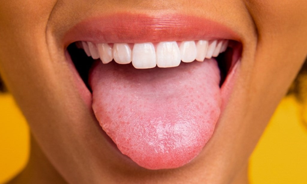 White Bump On Tongue Tip Images And Photos Finder